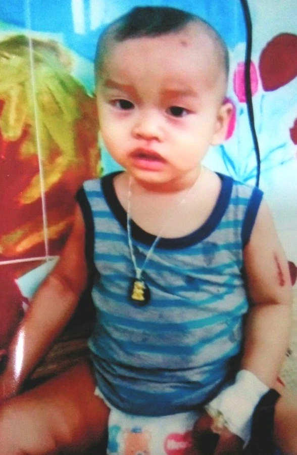 Giúp bé một tuổi bị ung thư xương